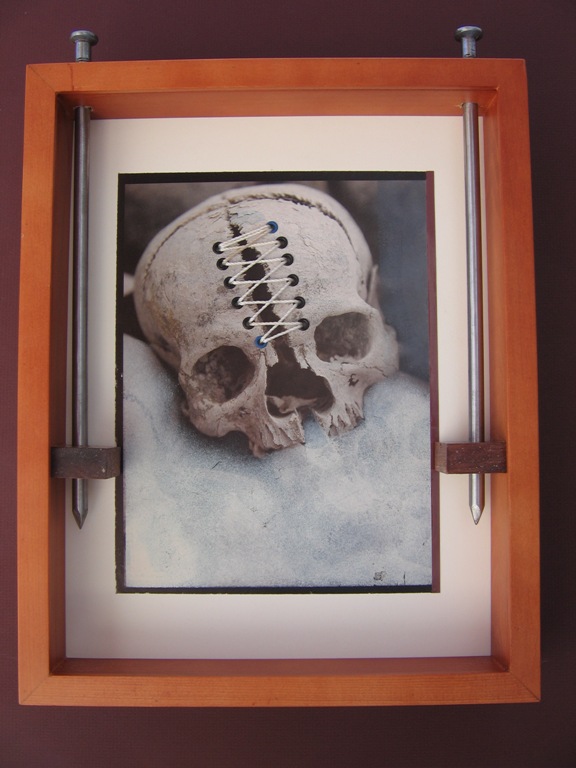 repaired skull, bob privitt, mixed media, assemblage