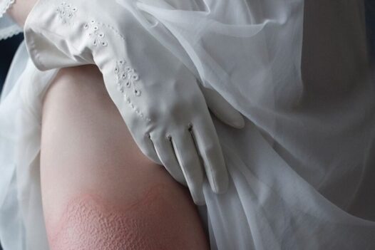Iness Rychlik Leg Skin Photography