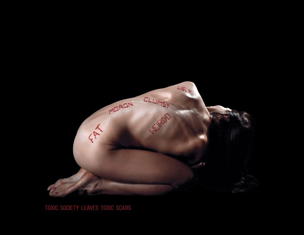 carmit haller-scars