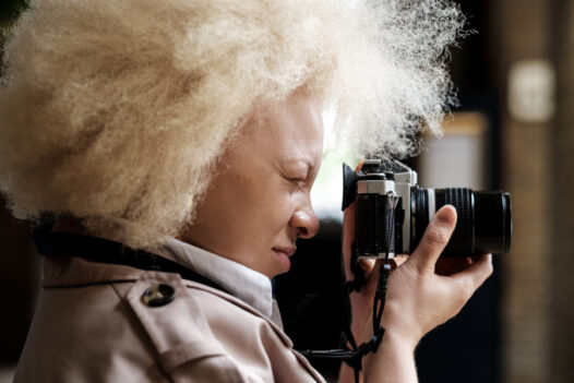 MPB-albino-female-photographer